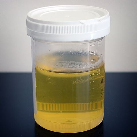 480px-Urine_sample