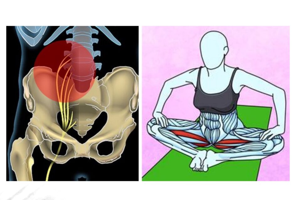 6 Esercizi Semplicissimi Per Liberarsi Del Mal Di Schiena E Del Dolore Al Nervo Sciatico